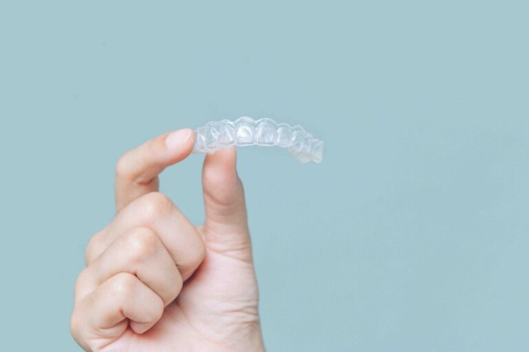 Quanto costa apparecchio trasparente